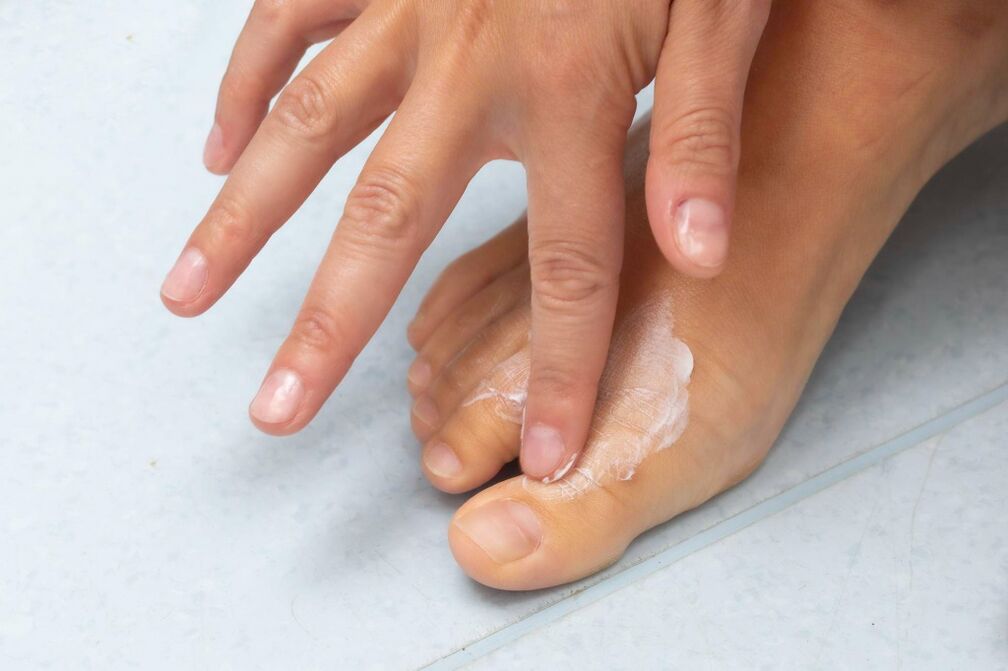 Ayak parmakları arasındaki mantardan demyxil krem